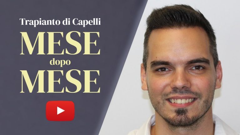 Trapianto capelli dopo quanto tempo crescono
