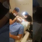 Dopo il trapianto di capelli ricrescono