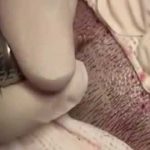 Dopo il trapianto di capelli ricrescono