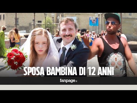 Trapianto capelli marocco