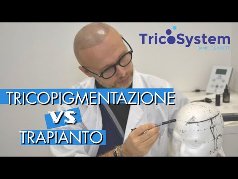 Trapianto capelli uomo prezzo