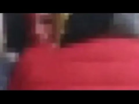 Red canzian trapianto capelli