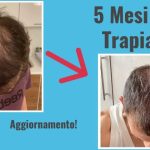 Dopo il trapianto di capelli ricrescono