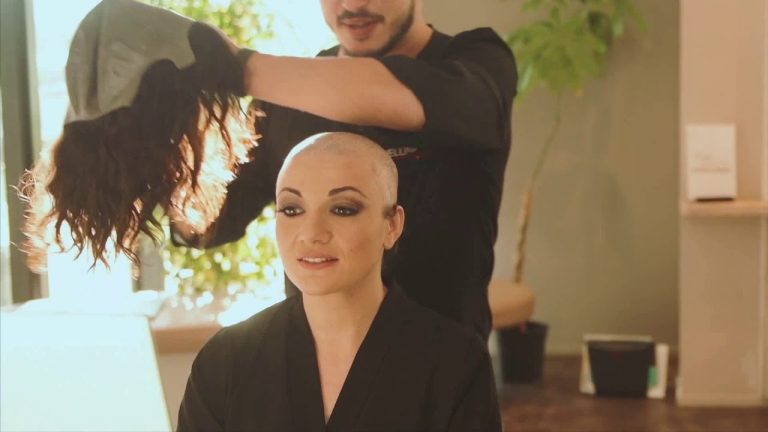 Trapianto di capelli donna bergamo