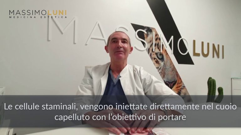 Bonolis trapianto capelli