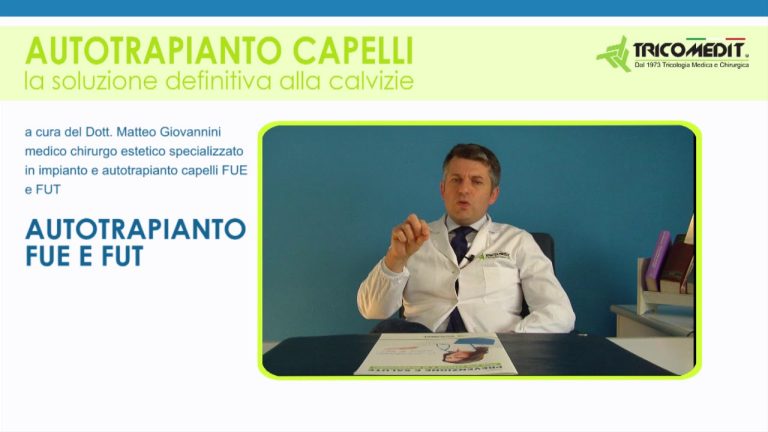 Boldi trapianto capelli