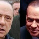 Dopo il trapianto di capelli ricrescono